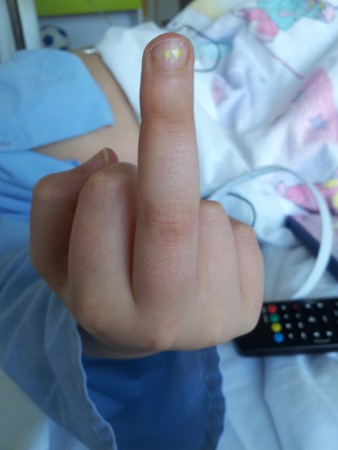 Net uit narcose... Rot op met die camera!